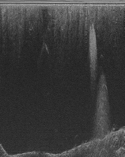 Thumbnail for vallakrabreen-20220505-DAT_0100_A1_1